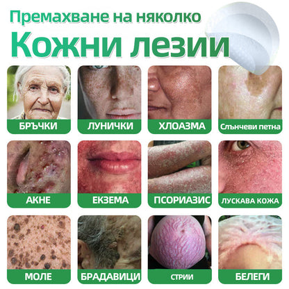 𝐇𝐮𝐝𝐫𝐨𝐬® 📌 𝟐-в-𝟏 хидроколоидни пластири с микроигли | Специално създадени за премахване на изпъкнали бенки, акне, плоски брадавици и кожни образувания | Опаковка от 𝟏𝟒𝟒 броя🌾🌾