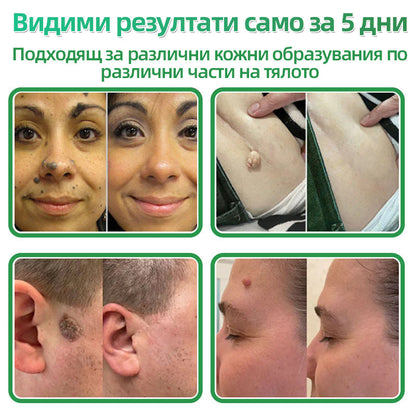 𝐇𝐮𝐝𝐫𝐨𝐬® 📌 𝟐-в-𝟏 хидроколоидни пластири с микроигли | Специално създадени за премахване на изпъкнали бенки, акне, плоски брадавици и кожни образувания | Опаковка от 𝟏𝟒𝟒 броя🌾🌾