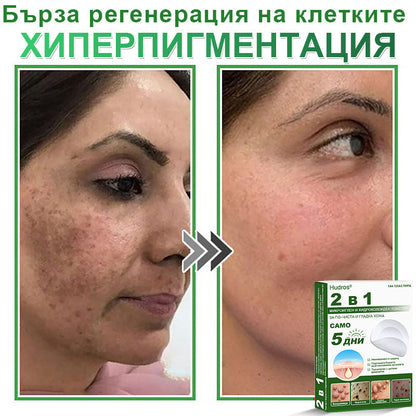 𝐇𝐮𝐝𝐫𝐨𝐬® 📌 𝟐-в-𝟏 хидроколоидни пластири с микроигли | Специално създадени за премахване на изпъкнали бенки, акне, плоски брадавици и кожни образувания | Опаковка от 𝟏𝟒𝟒 броя🌾🌾