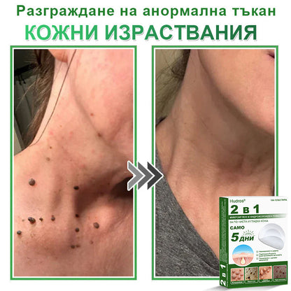 𝐇𝐮𝐝𝐫𝐨𝐬® 📌 𝟐-в-𝟏 хидроколоидни пластири с микроигли | Специално създадени за премахване на изпъкнали бенки, акне, плоски брадавици и кожни образувания | Опаковка от 𝟏𝟒𝟒 броя🌾🌾