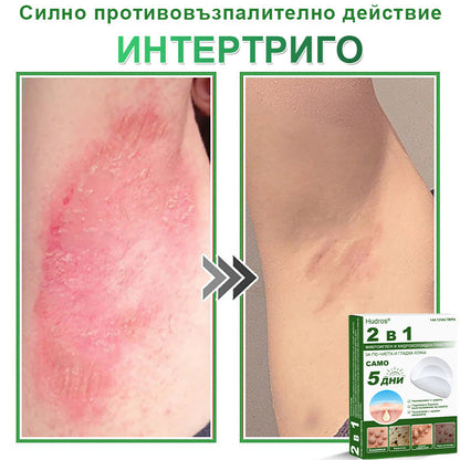 𝐇𝐮𝐝𝐫𝐨𝐬® 📌 𝟐-в-𝟏 хидроколоидни пластири с микроигли | Специално създадени за премахване на изпъкнали бенки, акне, плоски брадавици и кожни образувания | Опаковка от 𝟏𝟒𝟒 броя🌾🌾